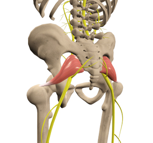  Piriformis Syndrome